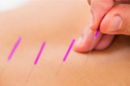 鍼灸で不妊治療を行っていくには